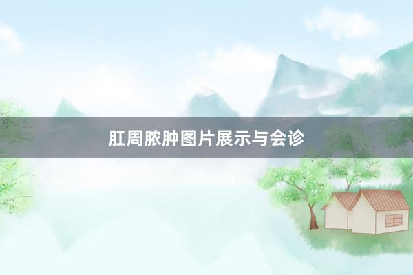 肛周脓肿图片展示与会诊